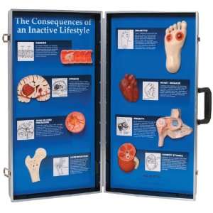 3B Scientific W43147 Consequences of An Inactive Lifestyle 3D Display 