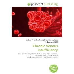  Chronic Venous Insufficiency (9786134177184) Books