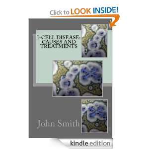   Treatment Options John Smith MA, M Awad MD  Kindle Store