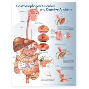 Gastroesophageal Disorders and Digestive Anatomy Chart Unmounted 